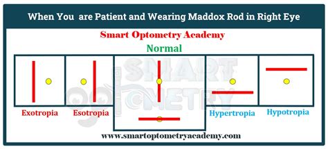 worth 4 dot test|maddox rod interpretation.
